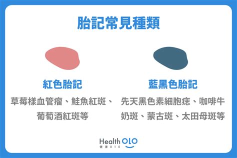 大腿胎記|胎記怎麼產生、何時消除？醫師剖析胎記種類、胎記寓意